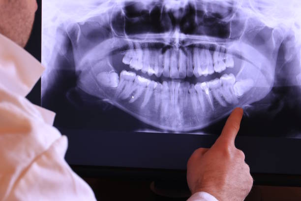 Best Holiday Emergency Dentist in Los Gatos, CA