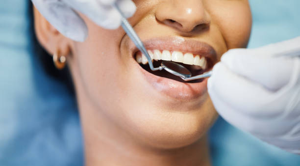 Best Emergency Cosmetic Dentistry in Los Gatos, CA