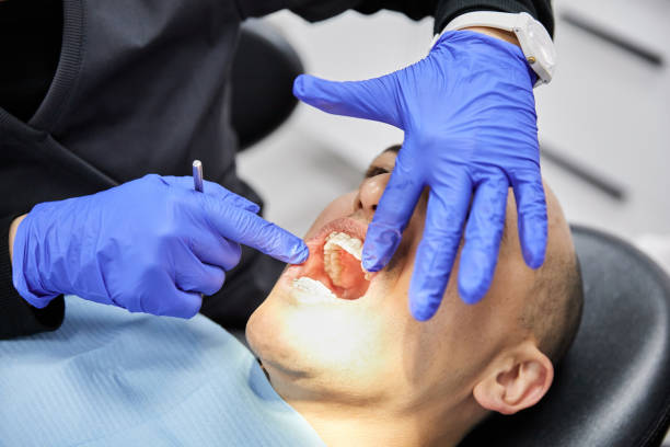 Best Emergency Cosmetic Dentistry in Los Gatos, CA